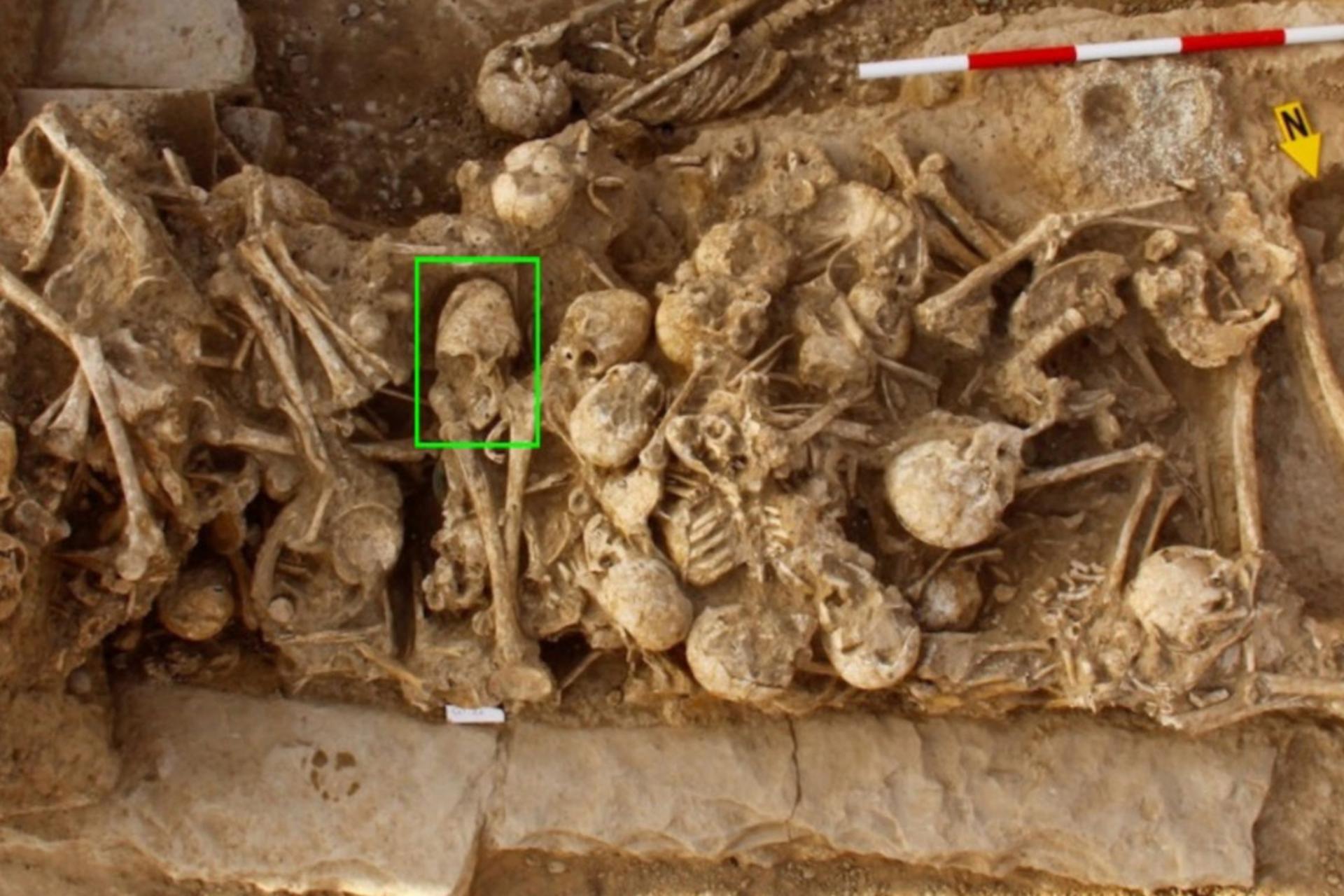 زن جوان با جمجمه‌ای تغییرشکل‌یافته در میان دیگران در گورستانی پیشاتاریخی در ایران